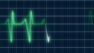 Medical Oscilloscope Line Loop - Video HD